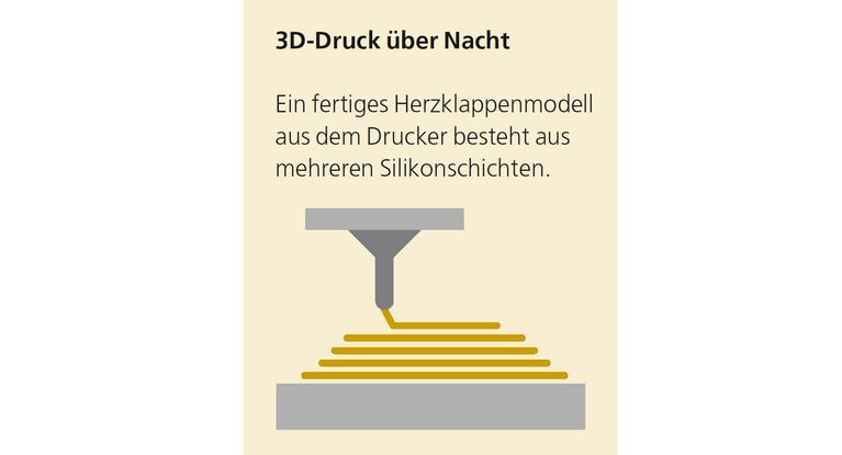 3D-Drucker im MEDICLIN Herzzentrum Lahr 3-D-Druck