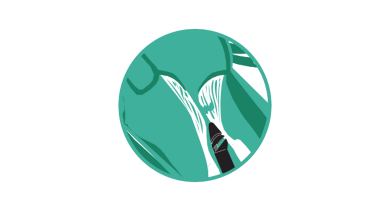 Einführung des Geräts