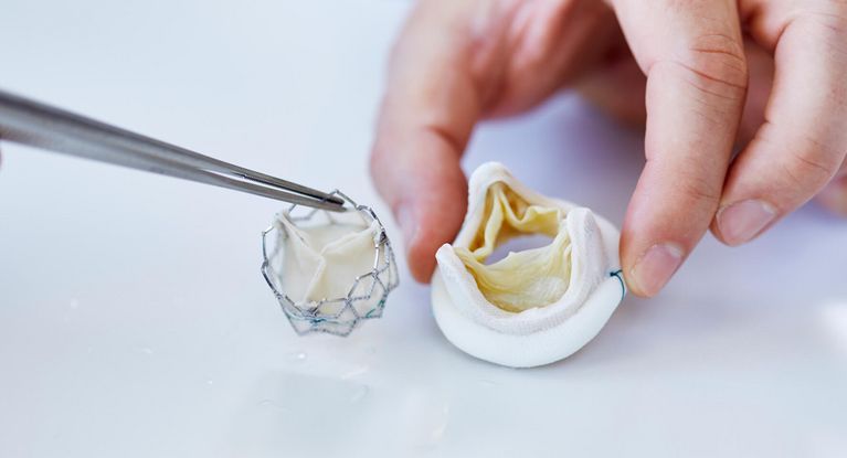 künstliche Herzklappe