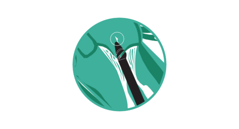 Aufsetzen des Geräts