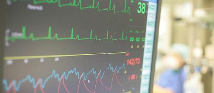 Wenn das Herz aus dem Rhythmus gerät