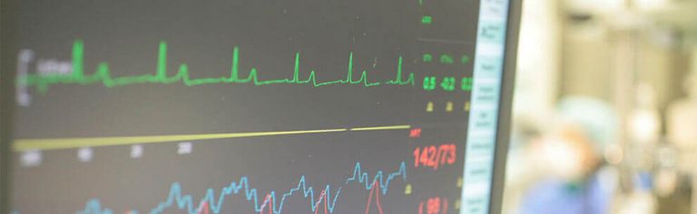 Monitor zeigt Vitalwerte eines Patienten während der OP an