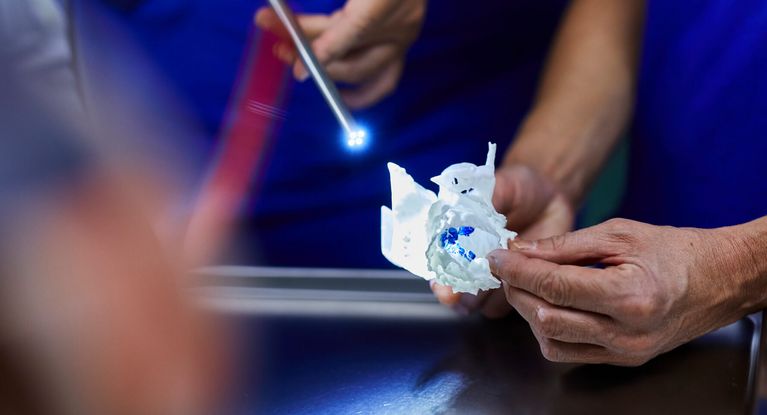 3D Implantat 3D Implantat