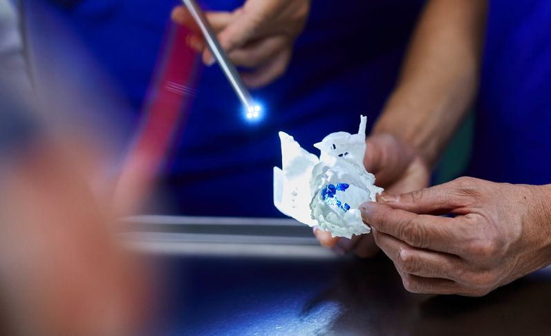 3D Implantat