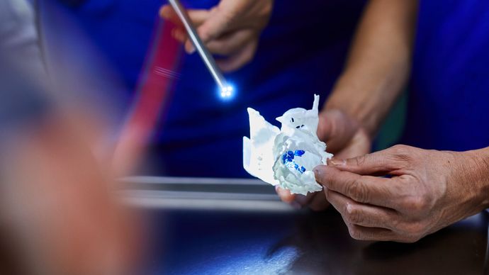 3D Implantat