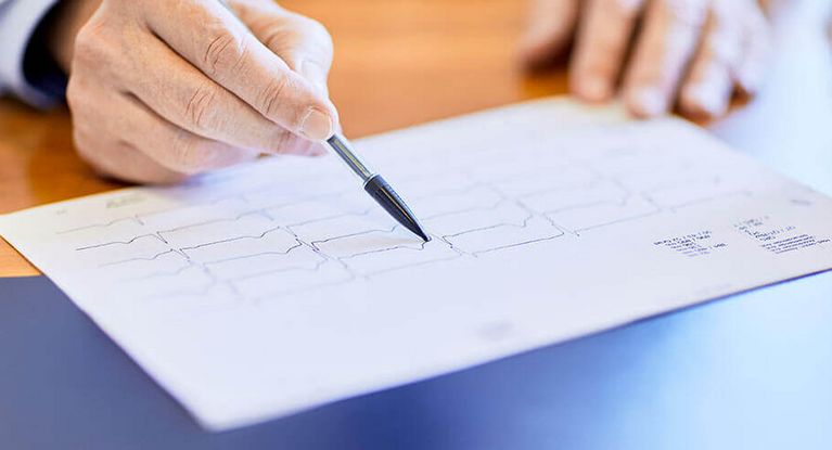 kardiologische Untersuchung 